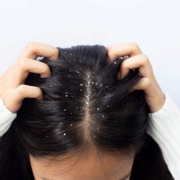 Dandruff vs. Dry Scalp: Why Most People Treat the Wrong One